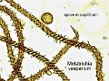 Metatrichia vesparium-amf2224-micro